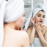 Melasma Treatment in Dubai – Causes, Hormonal Triggers, and Safe Correction Methods